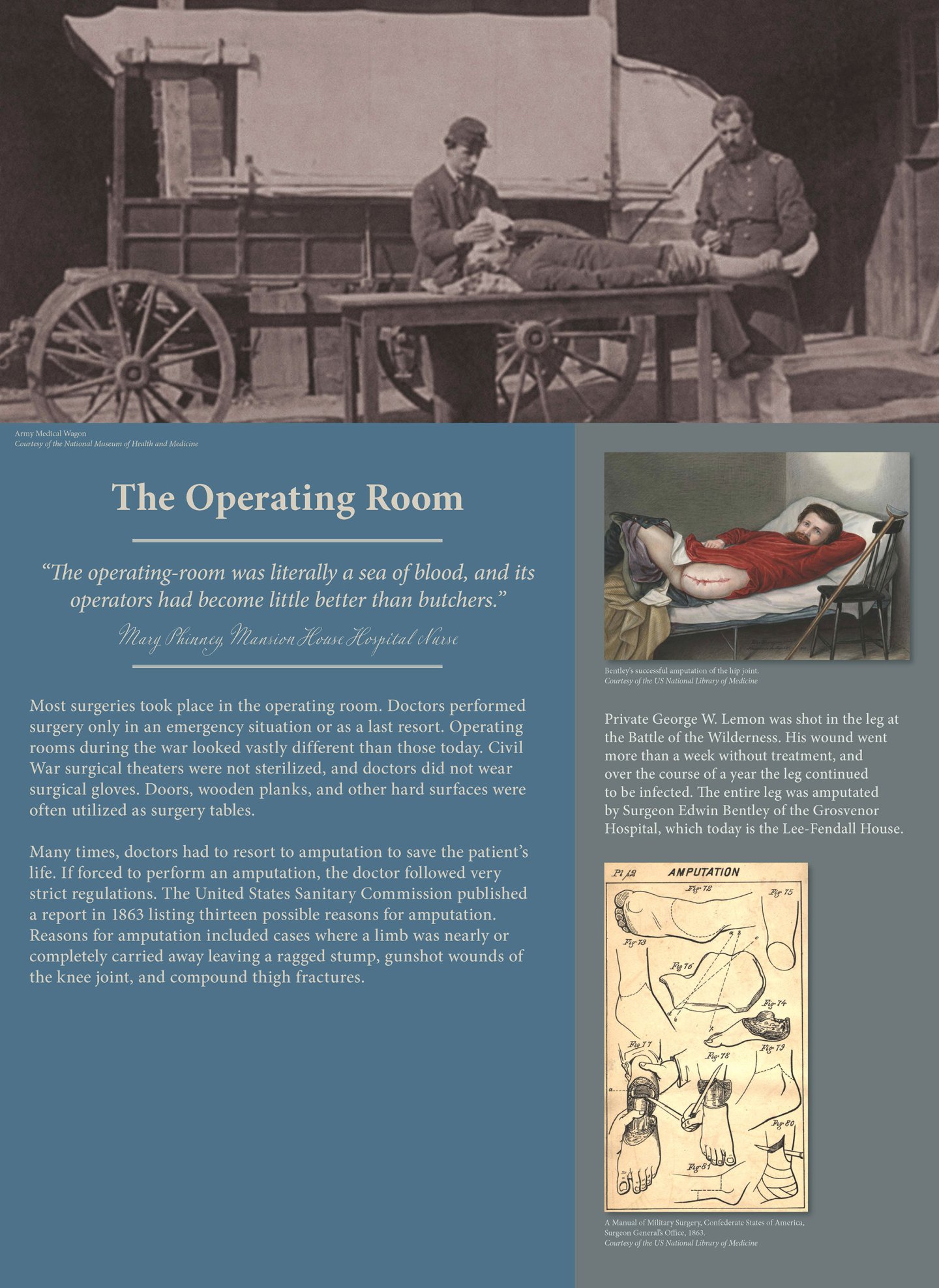 Mercy Street Exhibit - the Operating Room